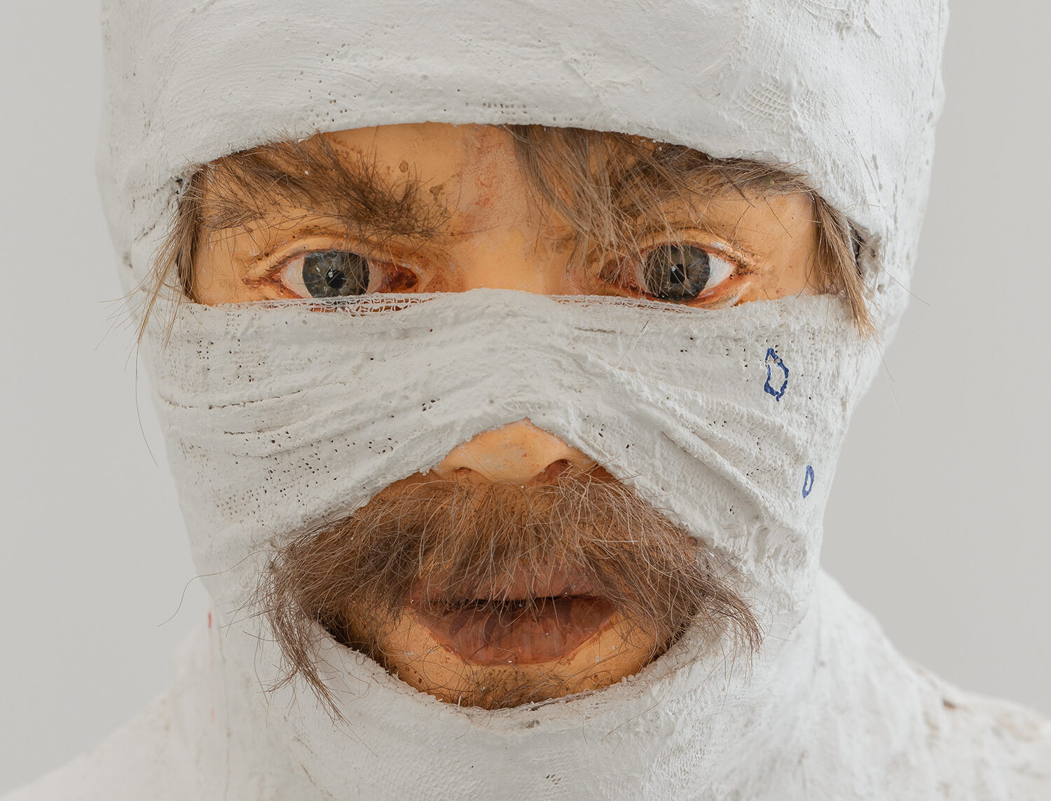 A sculpture of a male face with light skin wrapped in plaster bandages. Only the eyes and mouth are visible, and brown facial hair sticks out beneath the plaster.